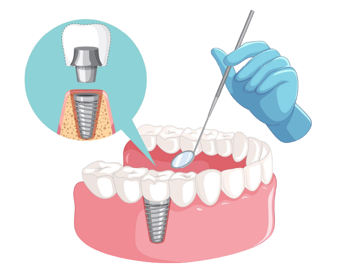 Periodontoloji