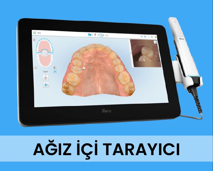 Ağız İçi Tarayıcılar
